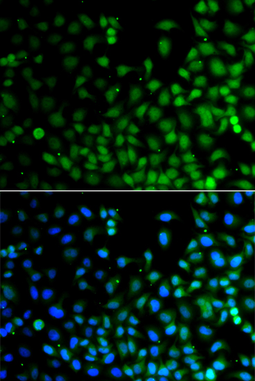 LHX6 Polyclonal Antibody