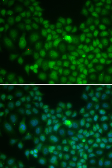 CLU antibody