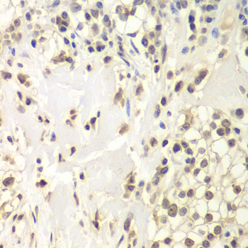 HAUSP / USP7 Polyclonal Antibody