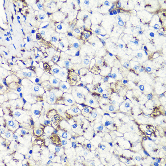 ALB antibody