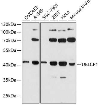 UBLCP1 Polyclonal Antibody