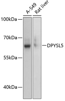 DPYSL5 Polyclonal Antibody