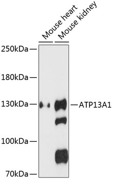 ATP13A1 Polyclonal Antibody