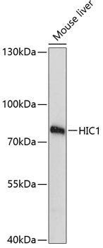 HIC1 Polyclonal Antibody