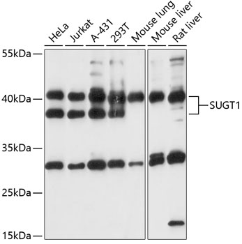 SUGT1 Polyclonal Antibody
