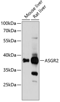 ASGR2 Polyclonal Antibody