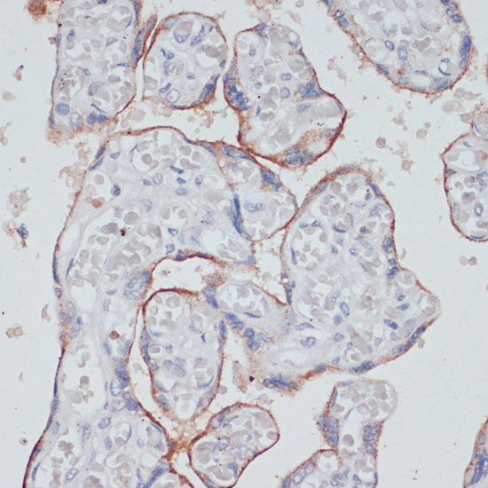 TFRC Antibody