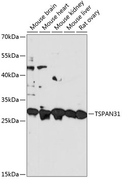 TSPAN31 Polyclonal Antibody