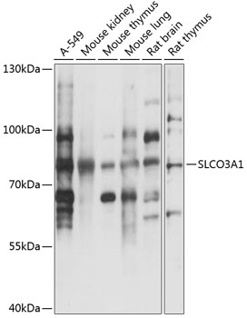 SLCO3A1 Polyclonal Antibody
