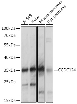 CCDC124 Polyclonal Antibody