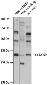 CCDC59 Polyclonal Antibody