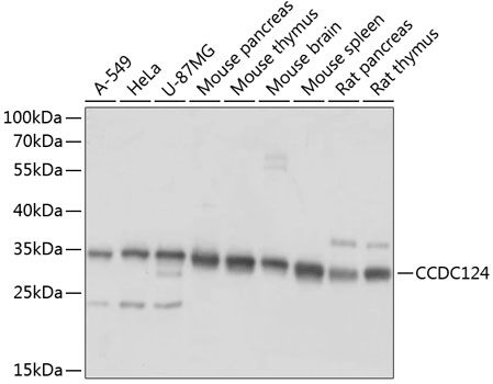 CCDC124 Polyclonal Antibody