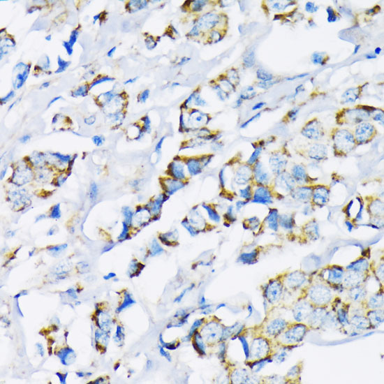 HK2 Antibody