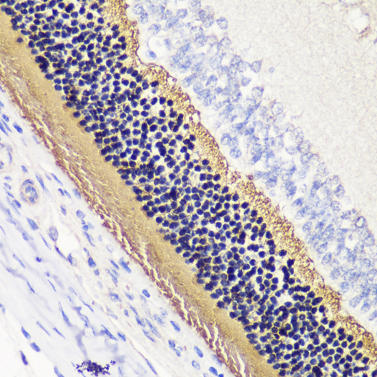 PDC Polyclonal Antibody