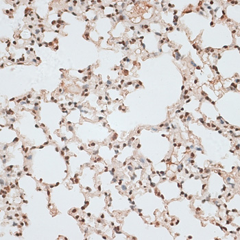 ZNF141 Polyclonal Antibody