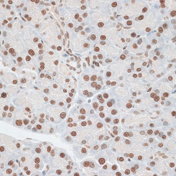 ZNF177 Polyclonal Antibody