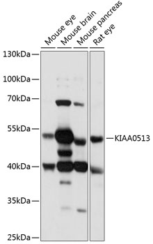 KIAA0513 Polyclonal Antibody
