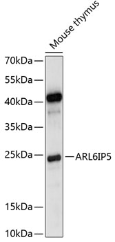 ARL6IP5 Polyclonal Antibody