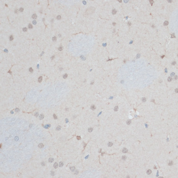 ZNF415 Polyclonal Antibody