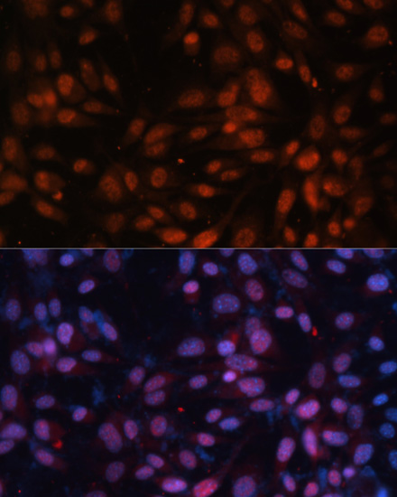 ZNF574 Polyclonal Antibody
