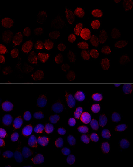CYP2J2 Polyclonal Antibody