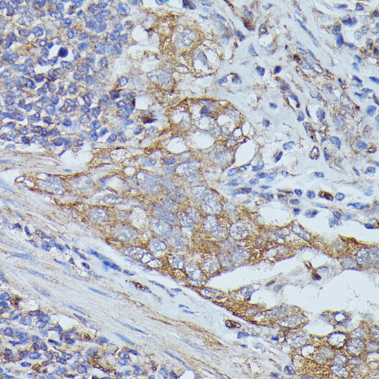 CTTN Polyclonal Antibody