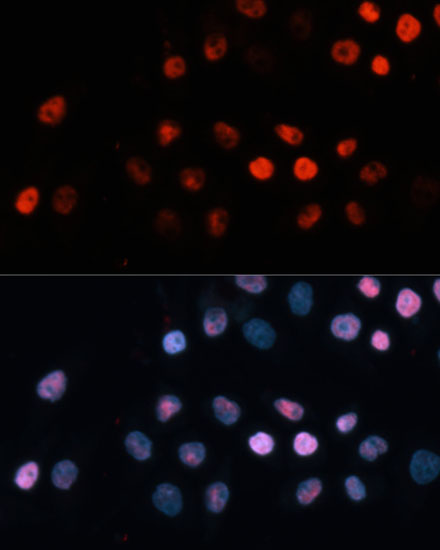 TET1 antibody