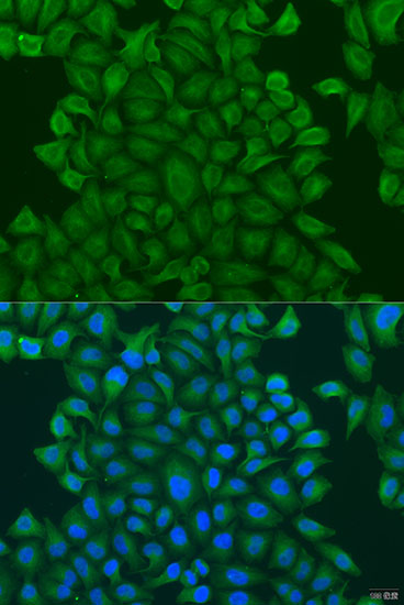 GSTM3 Polyclonal Antibody