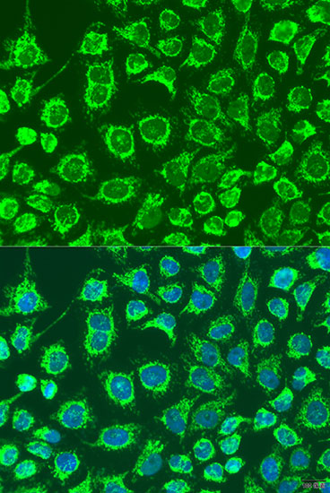 GYPB Polyclonal Antibody