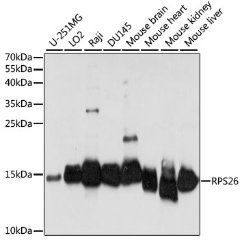 RPS26 Polyclonal Antibody