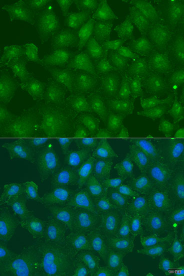 ZBTB20 Polyclonal Antibody