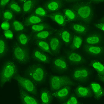 TERF2IP Polyclonal Antibody