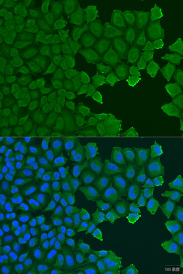TCTN2 Polyclonal Antibody
