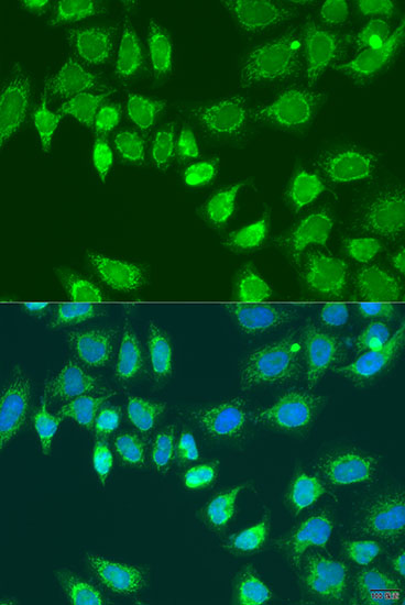 L2HGDH Polyclonal Antibody