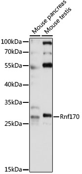 Rnf170 Polyclonal Antibody