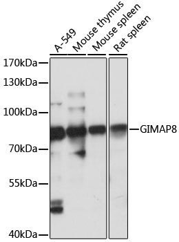 GIMAP8 Polyclonal Antibody