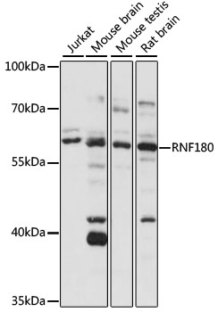 RNF180 Polyclonal Antibody