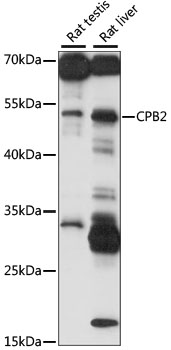 CPB2 Polyclonal Antibody