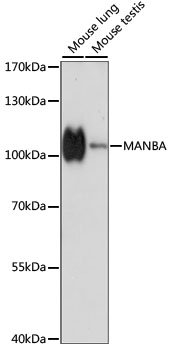 MANBA Polyclonal Antibody