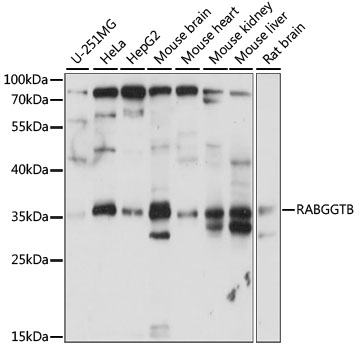 RABGGTB Polyclonal Antibody