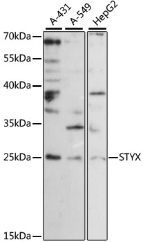 STYX Polyclonal Antibody