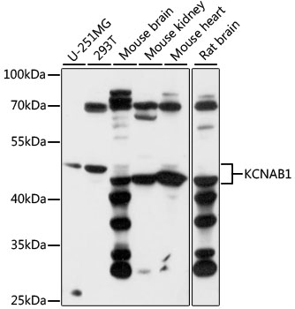 KCNAB1 Polyclonal Antibody