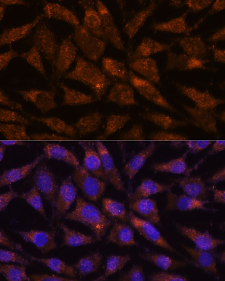 LMAN2 Polyclonal Antibody