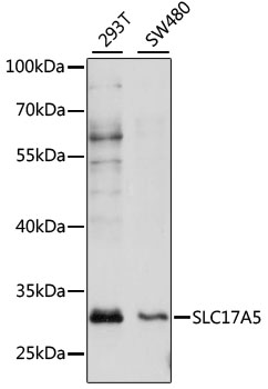 SLC17A5 Polyclonal Antibody