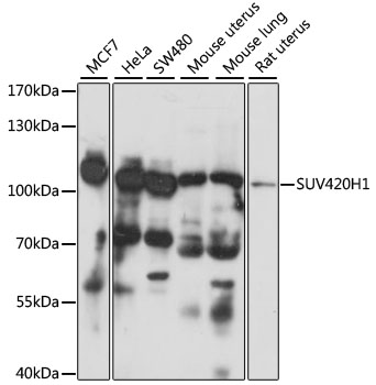 SUV420H1 Polyclonal Antibody