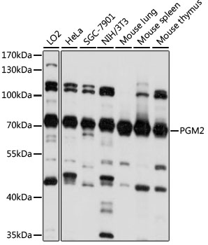 PGM2 Polyclonal Antibody