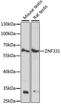 ZNF331 Polyclonal Antibody