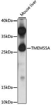 TMEM55A Polyclonal Antibody