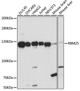 RBM25 Polyclonal Antibody