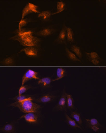 HOPX Polyclonal Antibody